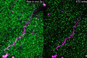 Thousands of SEP-GluA2 tagged synapses (shown in green) surround a sparsely labeled dendrite (show in magenta) before and after XTC image resolution enhancement. Scale bar is 5 microns.