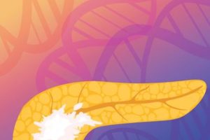 Pancreatic tumor DNA in circulation can be used by novel AI blood test to determine response to cancer therapy. Credit: Carolyn Hruban
